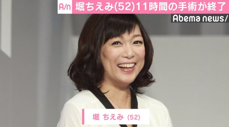 口腔がんを公表したタレントの堀ちえみ(52)が22日、都内の病院で手術を受け、無事に終了したことを、公式ブログを通じて堀の夫が報告した。
